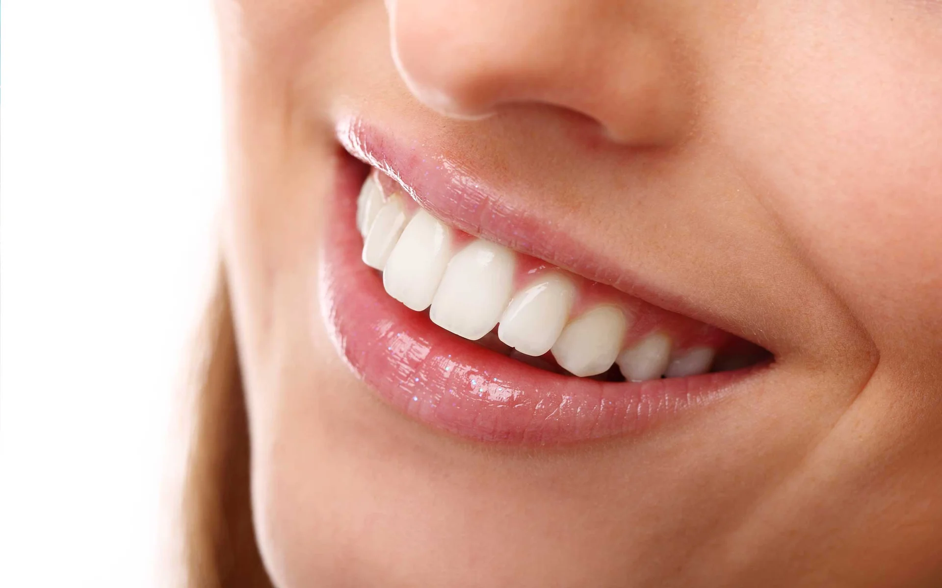 Hollywood Smile: The Perfect Blend of Confidence and Radiance