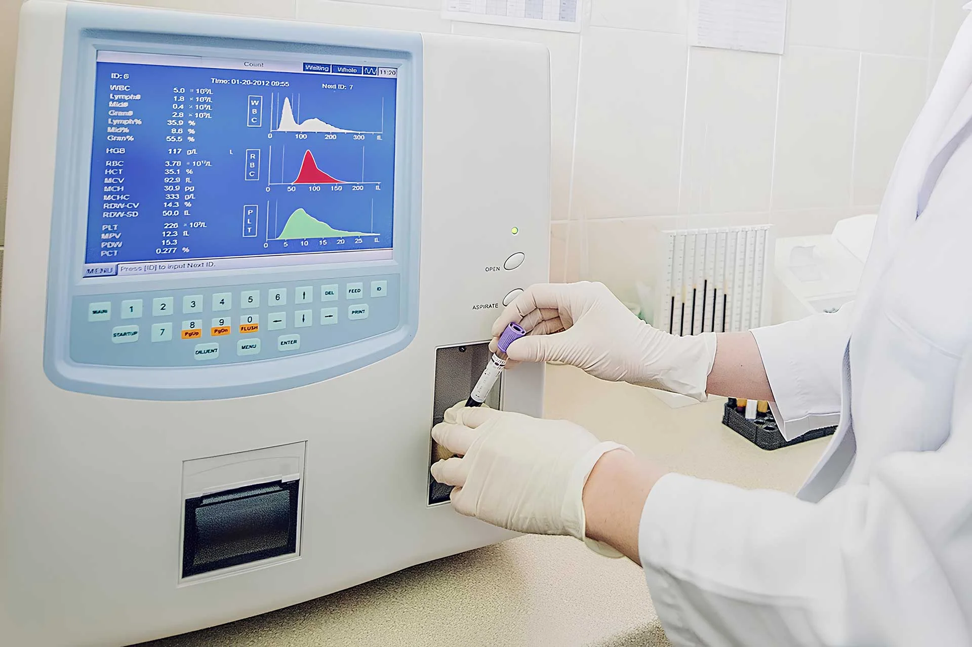 Understandıng The Parameters In Blood Tests And Theır Effects On Our Health
