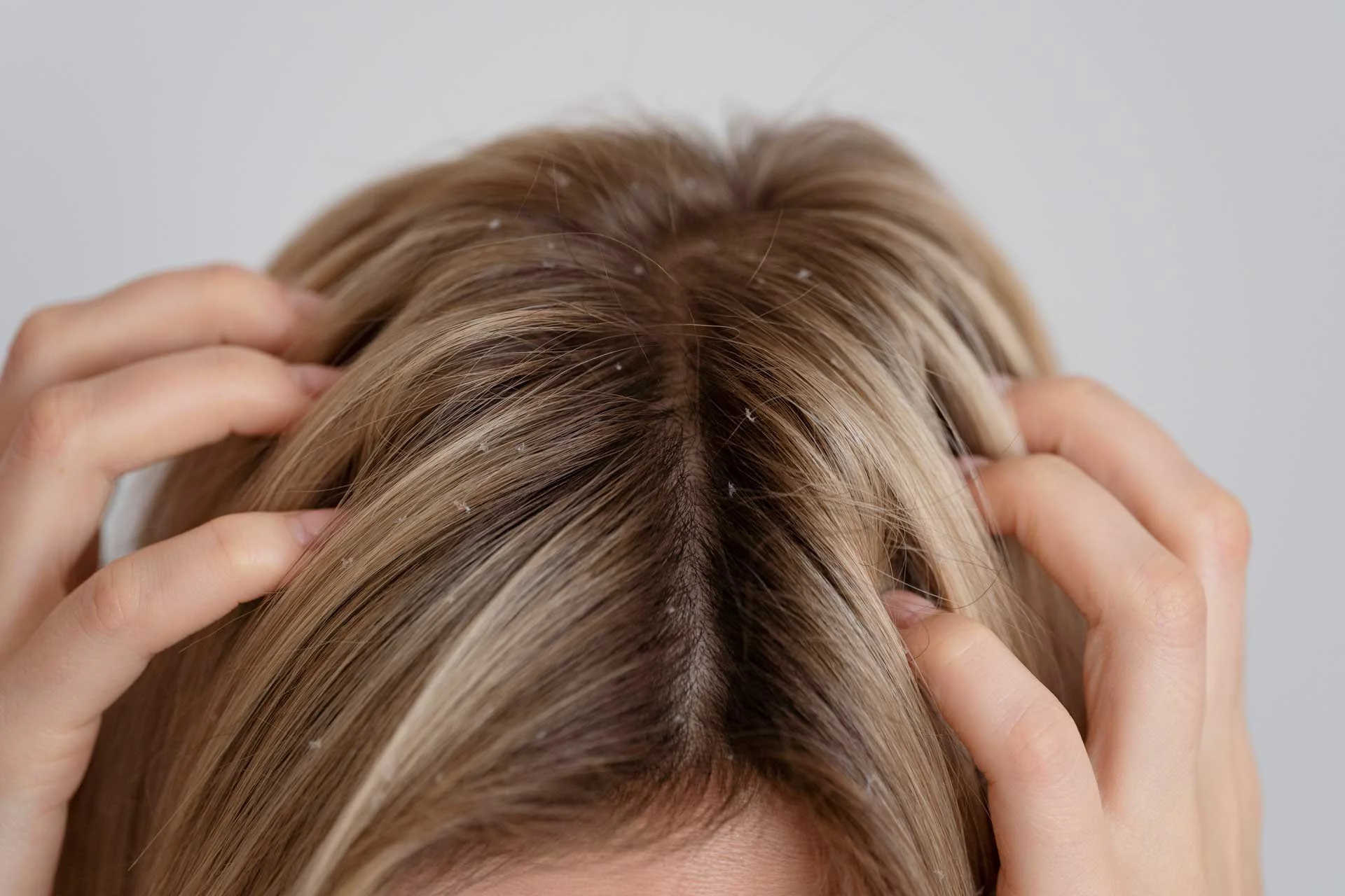 Hair Problems and Solutions