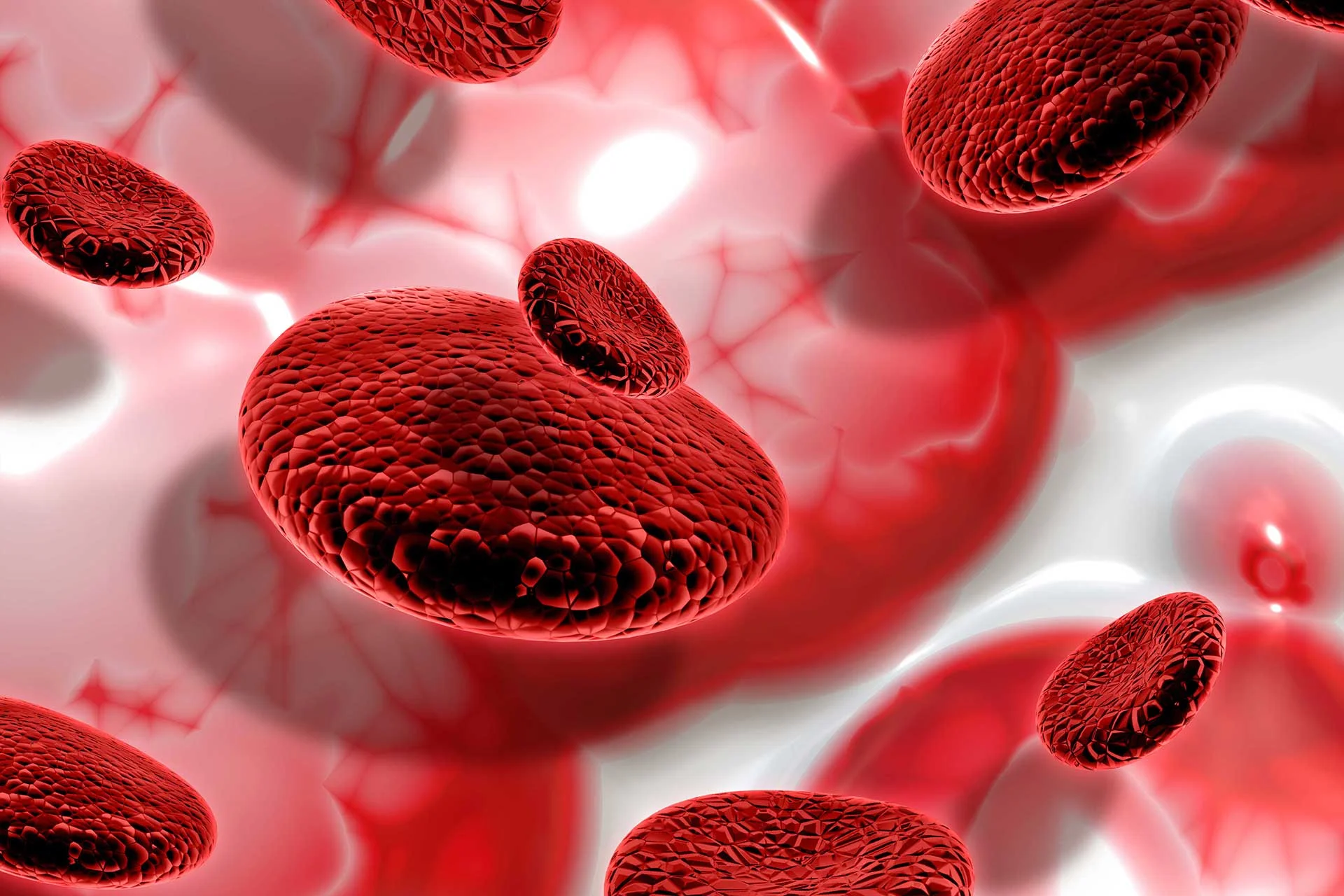 Iron Deficiency Anemia in Adults